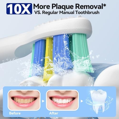 White ultrasonic toothbrush with ten heads — photo 3